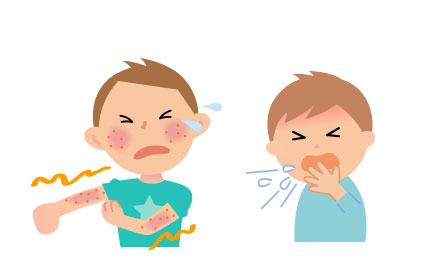 アレルギーについて