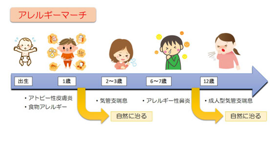 アレルギーマーチ