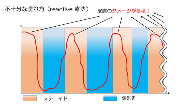 アトピー性皮膚炎の治療1