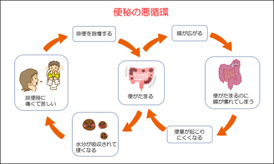 便秘とその原因